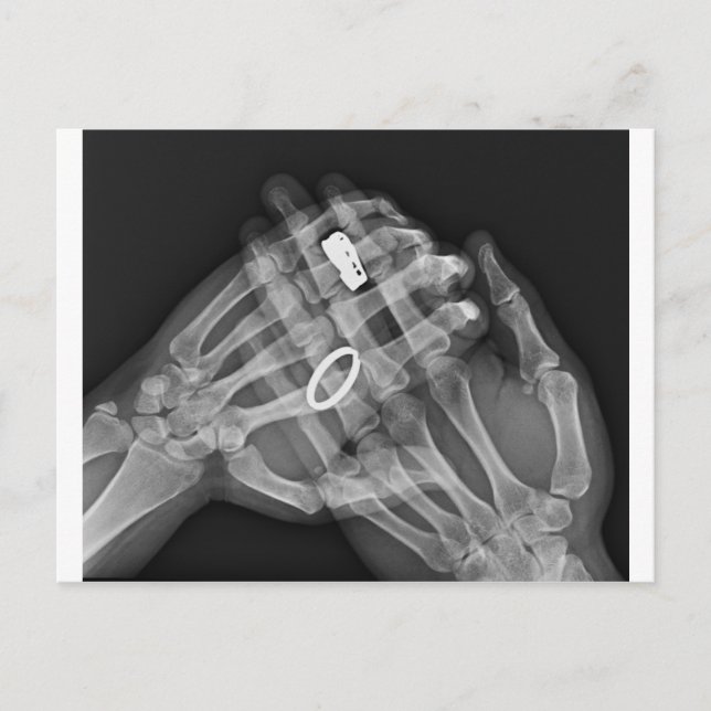 Cartão Postal Hand Holding (Frente)