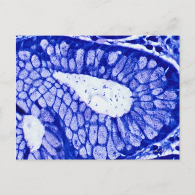Cartão Postal Helicobacter Pylori (Frente)