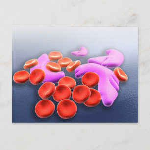 Cartão Postal Imagem Conceitual Da Anemia Das Células Falciform