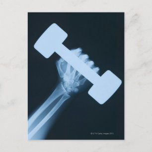 Cartão Postal Imagem de raio-X da mão humana com peso, aproximaç
