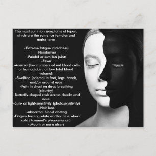 Cartão Postal Lupus, o sócio silencioso...