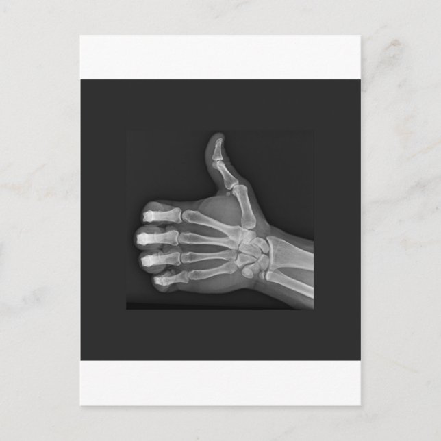 Cartão Postal Mumbs para cima (Frente)