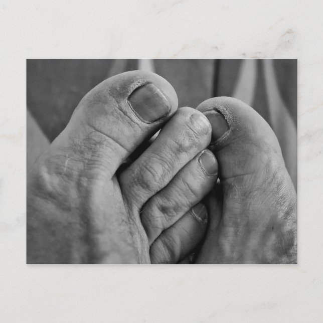 Cartão Postal Pés feios (Frente)