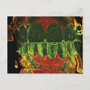 Cartão Postal Placa Orthodontist Design de Teeth Maluca