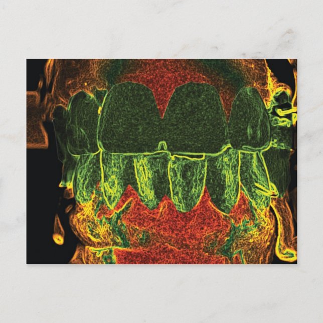 Cartão Postal Placa Orthodontist Design de Teeth Maluca (Frente)