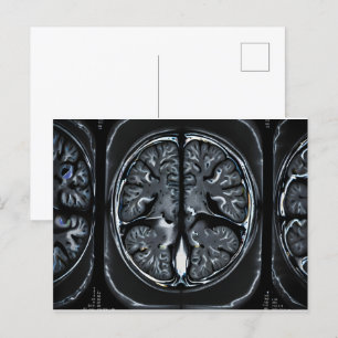 Cartão Postal ressonância magnética cerebral