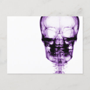 Cartão Postal Skeleton de visão de raios X - Roxo