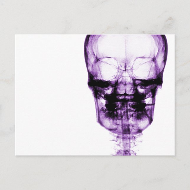 Cartão Postal Skeleton de visão de raios X - Roxo (Frente)