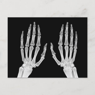 Cartão Postal Skeleton Hands Xray Imagem da Anatomia Humana
