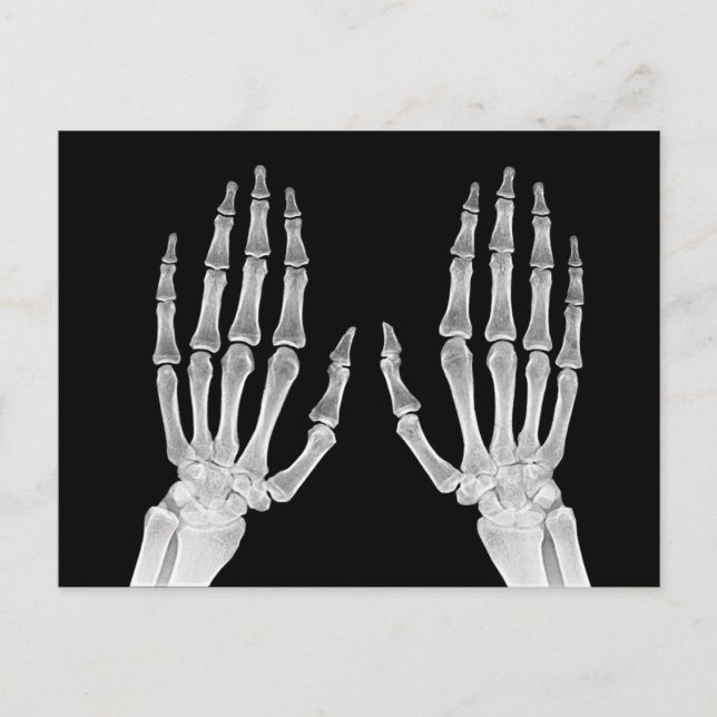 Cartão Postal Skeleton Hands Xray Imagem da Anatomia Humana (Frente)