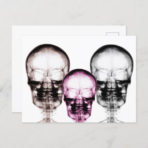 Cartão Postal Skeletons de Visão de Raios-X Misturados