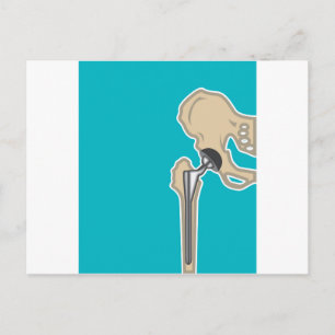 Cartão Postal Substituição da articulação da anca