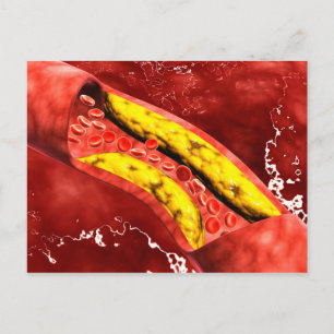 Cartão Postal Visão Microscópica De Dentro De Gesso Gordo Na Art