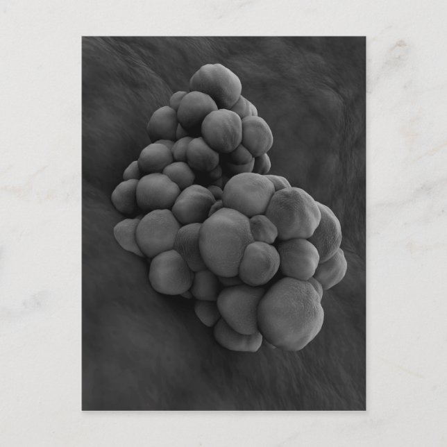 Cartão Postal Visão Microscópica Do Tumor 1 (Frente)