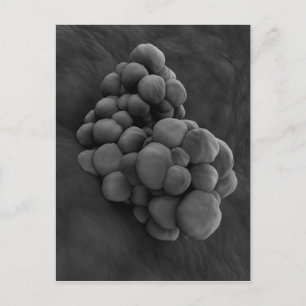 Cartão Postal Visão Microscópica Do Tumor 1