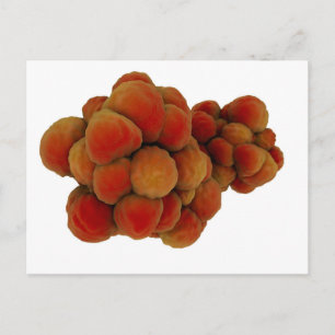 Cartão Postal Visão Microscópica Do Tumor 4