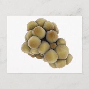 Cartão Postal Visão Microscópica Do Tumor 5