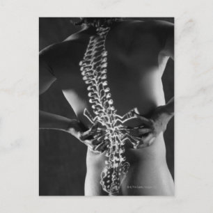 Cartão Postal Vista da espinal medula