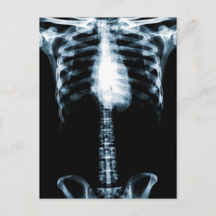 CARTÃO POSTAL X RAY SKELETON TORSO COR AZUL