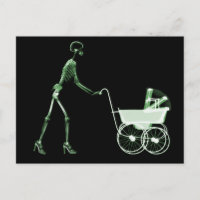 X RAY SKELETON WOMAN & BABY CARRUAGEM - VERDE