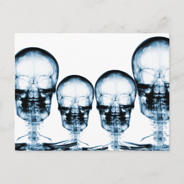 Cartão Postal X-Ray Vision Skeleton Skull - Blue (Frente)