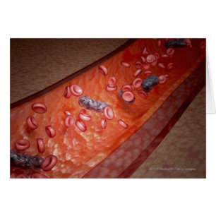 Cartão Rendição microscópica de uma infecção do sangue