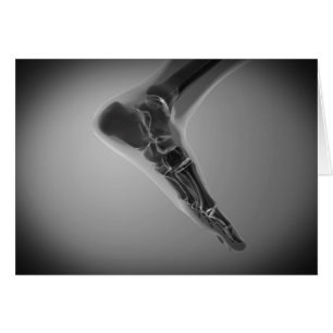 Cartão Visão De Raios X Do Pé Humano 4