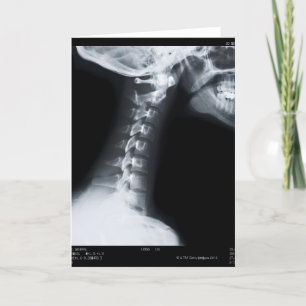Cartão X ray of neck vertebrae including lower jaw