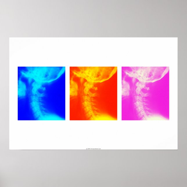 Cervical X-ray Chiropractic poster 2 (Frente)