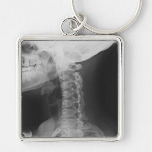 Chaveiro 2 radiografados