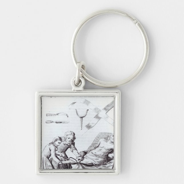 Chaveiro Operação cirúrgica para amputar um pé (Frente)