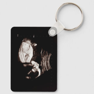 Chaveiro Ultrassom de Bebê Personalizado