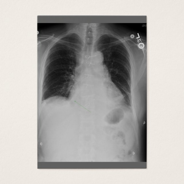 Cirurgia Cardíaca ~ ATC (Frente)