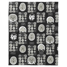 CT Scan_this é depression_BLK_CTFOD