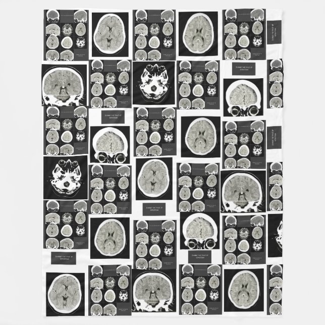 Cobertor De Velo CT Scan_this é depression_CTFOD (Frente)