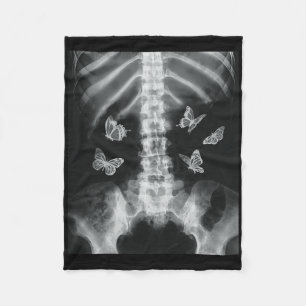 Cobertor De Velo Egirl Skeleton Xray Butterfly Harajuku Y2k Dark Ed