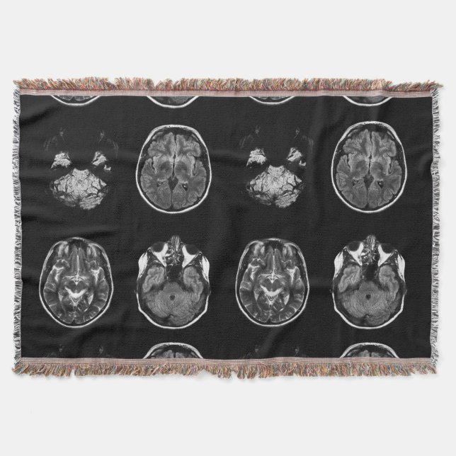 Cobertor Varredura por ressonância magnética do cérebro (Frente)