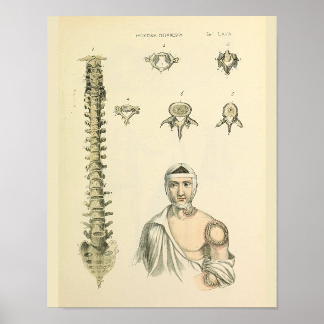 Coluna Spinal Impressão de Anatomia das Vertebras (Frente)