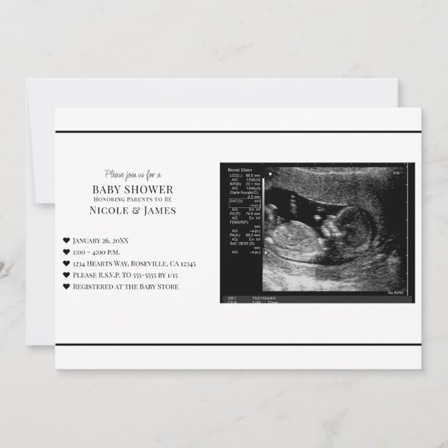 Convites Chá de Bebê Foto de Ultrassom Preto e Branco Minim (Frente)