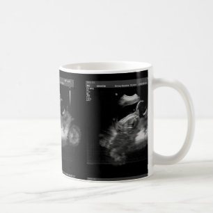 De Café Caneca do Sonogram da motocicleta
