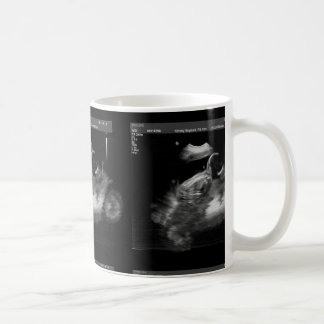 De Café Caneca do Sonogram da motocicleta