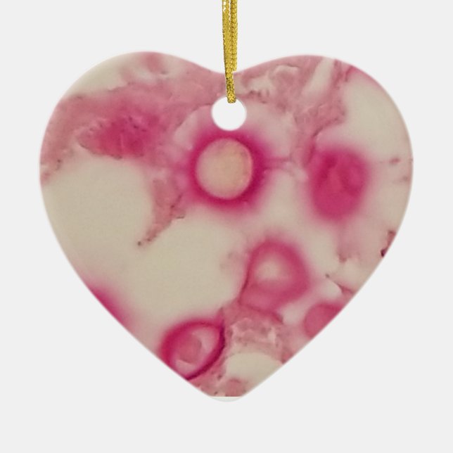 De Cerâmica Ornamento Criptococico (Frente)