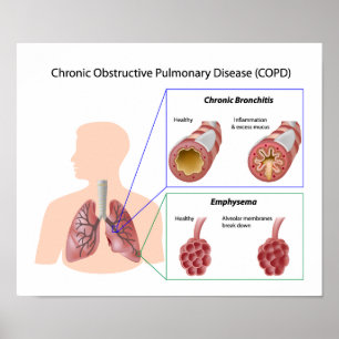 Doença pulmonar (DPOC) Poster
