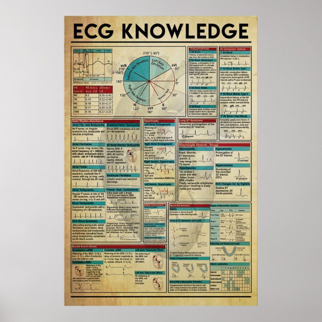 ECG Knowledge Poster, Cardiology Knowledge Poster (Frente)