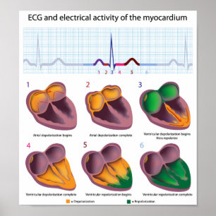ECG Poster de atividade elétrica do coração