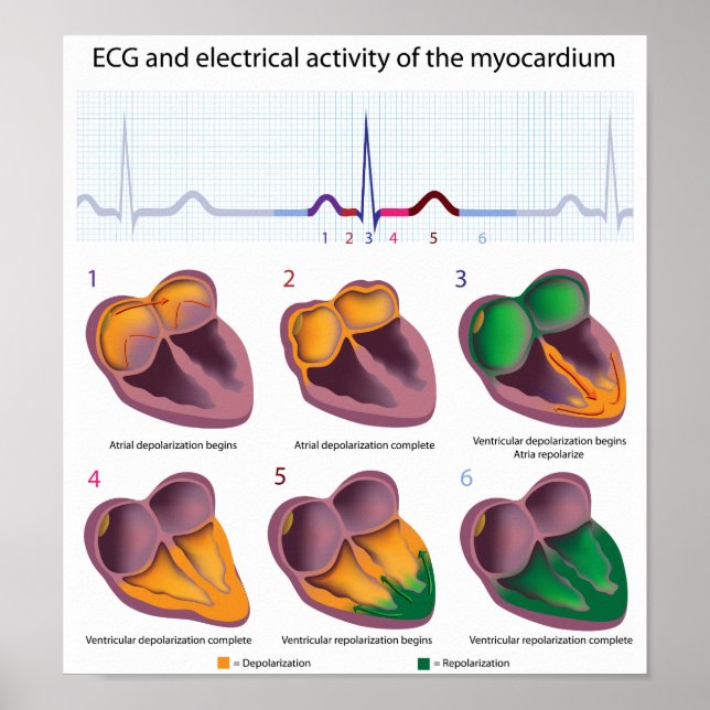 ECG Poster de atividade elétrica do coração (Frente)