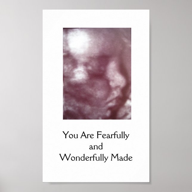 Feliz e maravilhosamente feito / Poster (Frente)