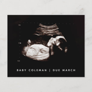 Flyer Gravidez Orçamento Sonograma de bebê Ultrassom F