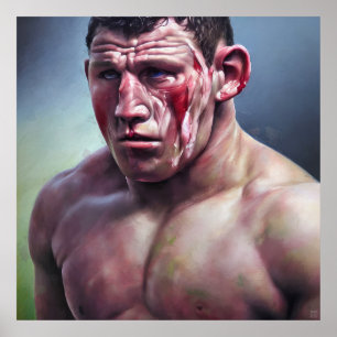 Foi Um Jogo Difícil - Impressão De Arte Canvas