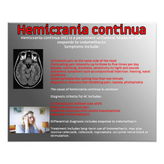 Foto Hemicrania continua